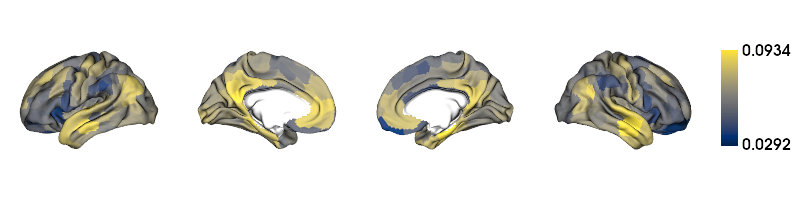 ../_images/tutorials_MRI-3T-rsfMRI_29_0.png