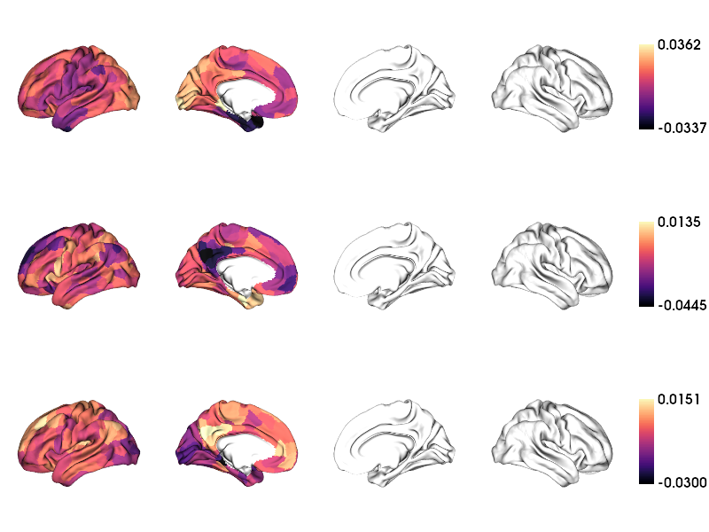 ../_images/tutorials_MRI-3T-rsfMRI_41_1.png