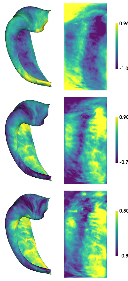 ../_images/tutorials_MRI-7T-struct_16_1.png